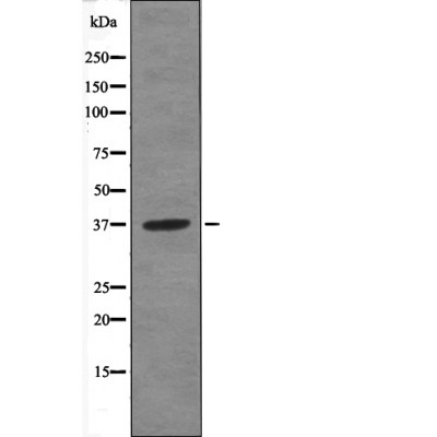 Rabbit Polyclonal Antibody to ANXA1 (Phospho-Tyr21)