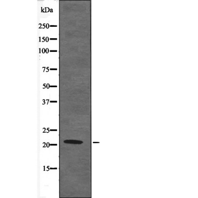 Rabbit Polyclonal Antibody to Claudin 4 (Phospho-Tyr208)