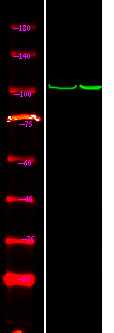 Rabbit Polyclonal Antibody to CTNND1 (Phospho-Tyr257)