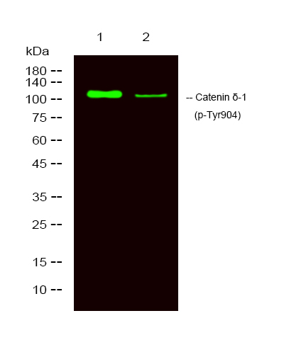 Rabbit Polyclonal Antibody to CTNND1 (Phospho-Tyr904)
