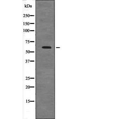 Rabbit Polyclonal Antibody to Cyclin B1 (Phospho-Ser128)