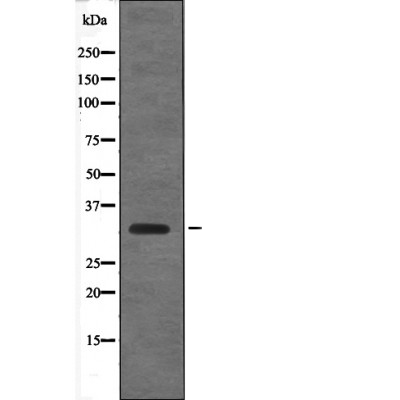 Rabbit Polyclonal Antibody to Cyclin D1 (Phospho-Thr288)