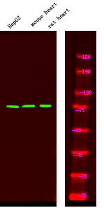 Rabbit Polyclonal Antibody to FKHR (Phospho-Ser249)