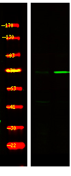 Rabbit Polyclonal Antibody to FKHRL1 (Phospho-Ser321)