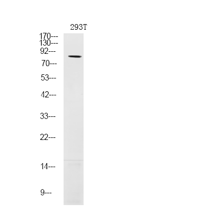 Rabbit Polyclonal Antibody to LIMK1 (Phospho-Ser310)