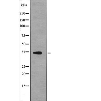 Rabbit Polyclonal Antibody to MCL1 (Phospho-Thr163)