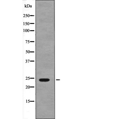 Rabbit Polyclonal Antibody to NACA (Phospho-Ser43)