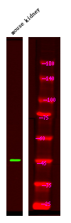 Rabbit Polyclonal Antibody to PSEN1 (Phospho-Ser353)