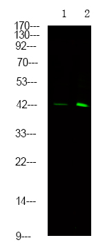 Rabbit Polyclonal Antibody to SPHK1 (Phospho-Ser225)