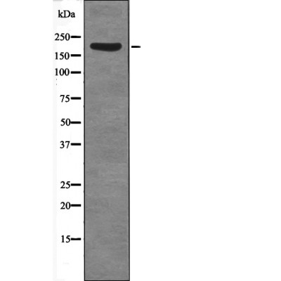 Rabbit Polyclonal Antibody to SRC-1 (Phospho-Thr1179)