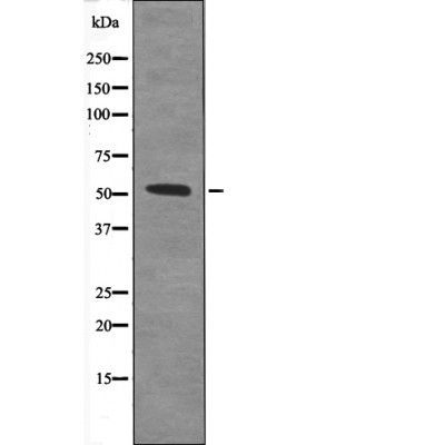 Rabbit Polyclonal Antibody to TAB1 (Phospho-Ser438)