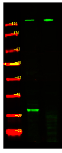 Rabbit Polyclonal Antibody to Tuberin (Phospho-Ser981)