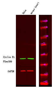 Rabbit Polyclonal Antibody to Cyclin E1 (Phospho-Ser399)