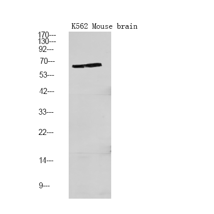 Rabbit Polyclonal Antibody to PFKFB2 (Phospho-Ser466)