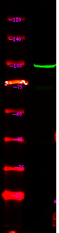 Rabbit Polyclonal Antibody to BTK (Phospho-Ser179)