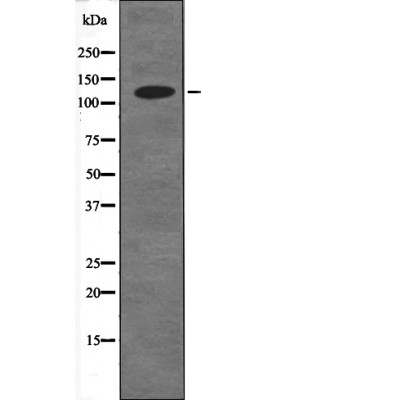 Rabbit Polyclonal Antibody to CDH1 (Phospho-Ser844)