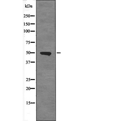 Rabbit Polyclonal Antibody to ETS1 (Phospho-Ser251)