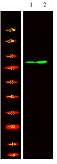 Rabbit Polyclonal Antibody to GRK1/2 (Phospho-Tyr13)