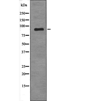 Rabbit Polyclonal Antibody to MDM2 (Phospho-Tyr394)