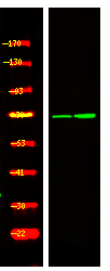 Rabbit Polyclonal Antibody to PRC1 (Phospho-Thr470)