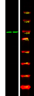 Rabbit Polyclonal Antibody to Androgen Receptor (Phospho-Ser308)