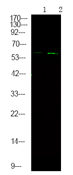 Rabbit Polyclonal Antibody to Chk2 (Phospho-Ser379)