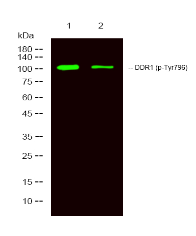 Rabbit Polyclonal Antibody to DDR1 (Phospho-Tyr796)