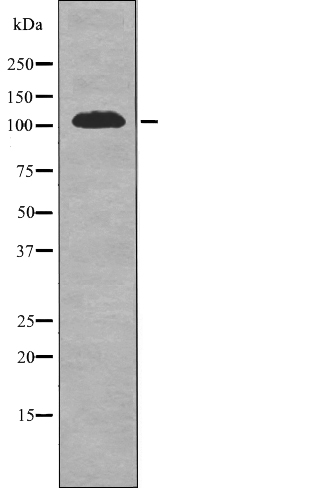 Rabbit Polyclonal Antibody to EPHA1 (Phospho-Tyr605)