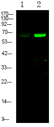 Rabbit Polyclonal Antibody to EPHA1 (Phospho-Tyr781)