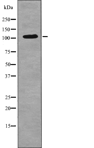 Rabbit Polyclonal Antibody to EPHA3 (Phospho-Tyr602)