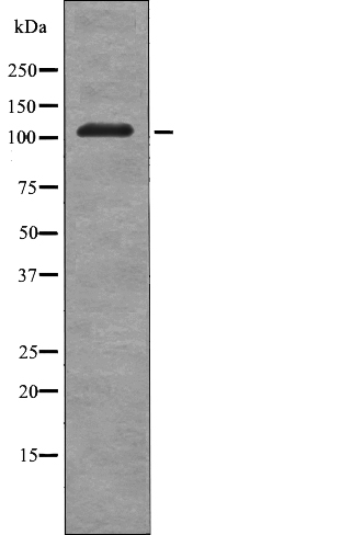 Rabbit Polyclonal Antibody to EPHB3 (Phospho-Tyr608)
