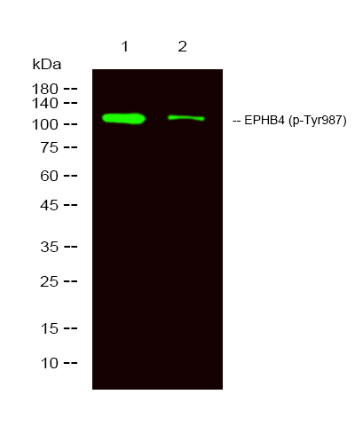 Rabbit Polyclonal Antibody to EPHB4 (Phospho-Tyr987)