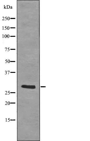 Rabbit Polyclonal Antibody to LAT (Phospho-Tyr255)