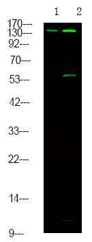 Rabbit Polyclonal Antibody to Met (Phospho-Tyr1313)