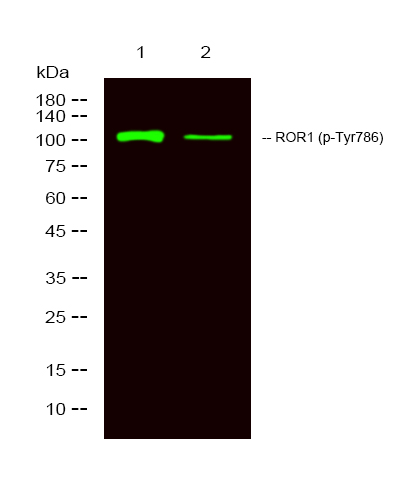 Rabbit Polyclonal Antibody to ROR1 (Phospho-Tyr786)