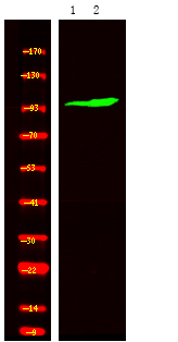 Rabbit Polyclonal Antibody to ROR2 (Phospho-Ser449)