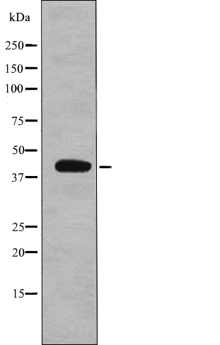 Rabbit Polyclonal Antibody to eIF2B (Phospho-Ser67)