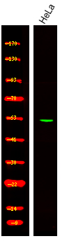 Rabbit Polyclonal Antibody to EIF5 (Phospho-Ser389+Ser390)