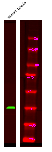 Rabbit Polyclonal Antibody to GFAP (Phospho-Ser13)