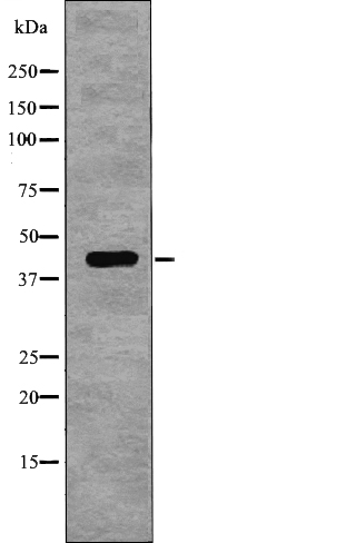 Rabbit Polyclonal Antibody to NDRG1 (Phospho-Thr346)