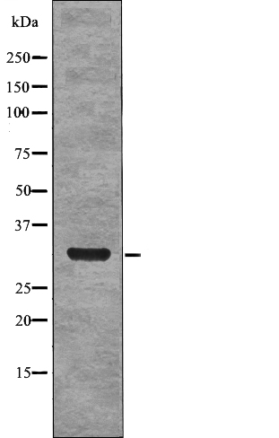Rabbit Polyclonal Antibody to NPM (Phospho-Ser4)