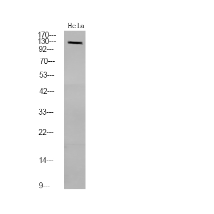 Rabbit Polyclonal Antibody to PDE3A (Phospho-Ser312)