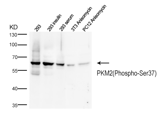 Rabbit Polyclonal Antibody to PKM2(Phospho-Ser37)