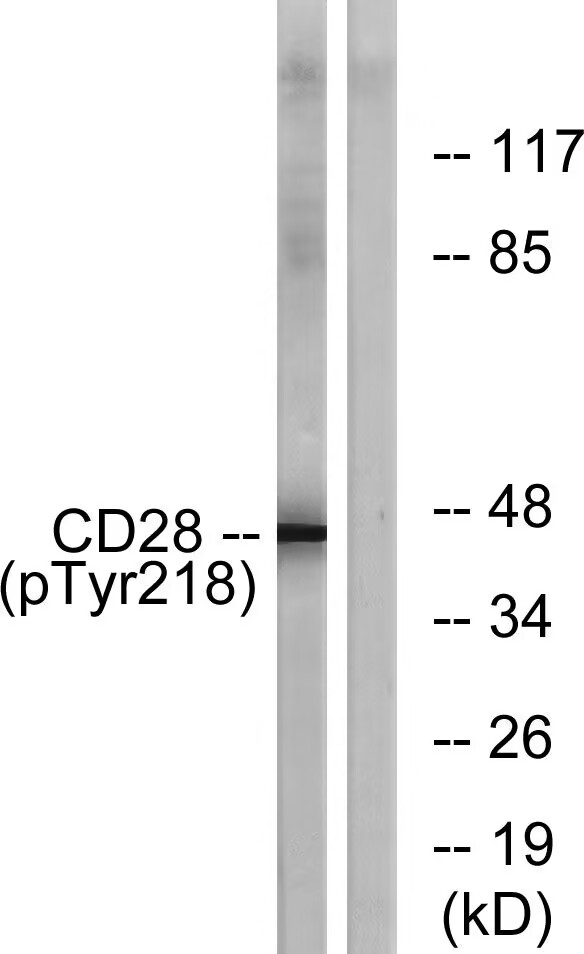 Rabbit Polyclonal Antibody to CD28 (Phospho-Tyr218)