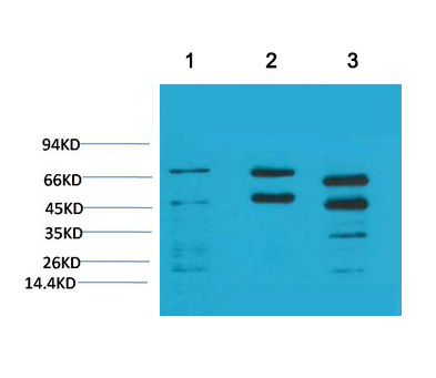 Mouse Monoclonal Antibody to Phosphoserine(5B12)