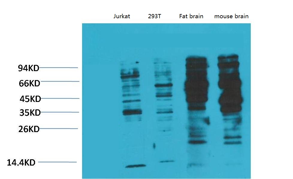 Mouse Monoclonal Antibody to Phosphotyrosine(2C1)
