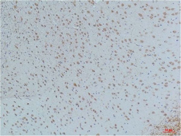 Mouse Monoclonal Antibody to CaMKIIβ/γ/δ(Phospho Thr287)(4H2)