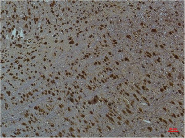 Mouse Monoclonal Antibody to CaMKIIβ/γ/δ(Phospho Thr287)(1B9)