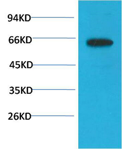 Mouse Monoclonal Antibody to Phospho-Akt (S473) Mouse(6F8)