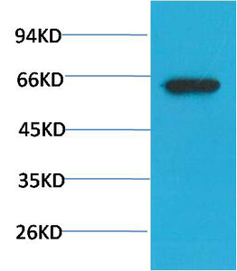 Mouse Monoclonal Antibody to Phospho-Akt (S473) Mouse(7F9)
